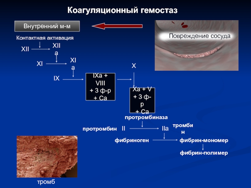 Схема коагуляционного гемостаза