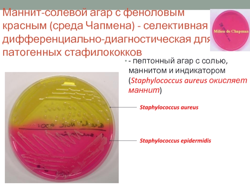 Staphylococcus aureus среда. Маннит солевой агар стафилококк. Маннит-солевой агар для Staphylococcus. Маннит солевой агар. Среда с маннитом для стафилококков.