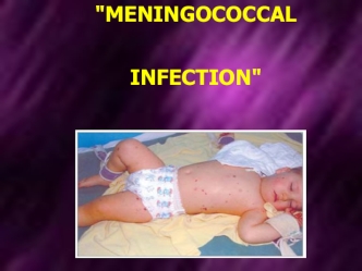 Meningococcal infection