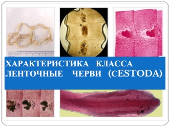 Характеристика класса ленточные черви