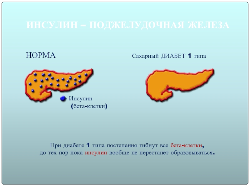 Сахарный диабет 1 типа презентация