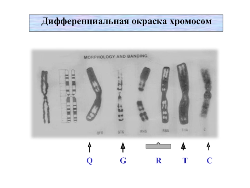 Изменение окраски хромосом. Методы дифференциальной окраски хромосом. Кариотип методом дифференциальной окраски хромосом. Q метод окрашивания хромосом. R метод окрашивания хромосом.