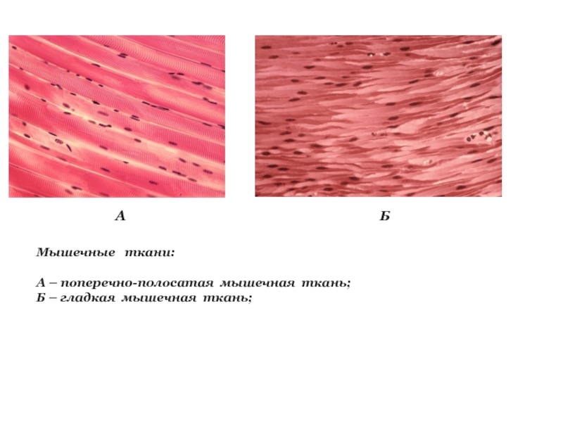 В поперечнополосатой мышечной ткани клетки какие