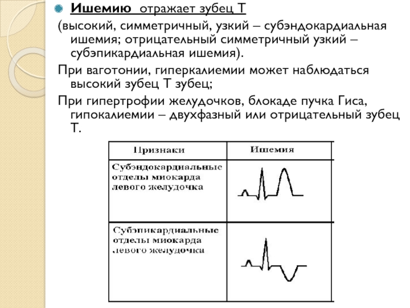 Экг отрицательный. Отрицательный зубец т причины. Высокий зубец т в v2 v3. Зубец т высокий на кардиограмме. Отрицательный коронарный зубец т.