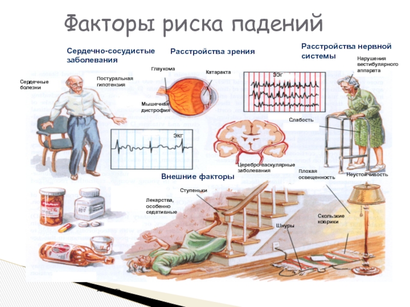 Фактор больна. Факторы риска падений. Факторы риска падения пациента. Факторы риска падения остеопороз. Фактор падения рывка это.