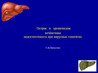 Острая и хроническая печёночная недостаточность при вирусных гепатитах