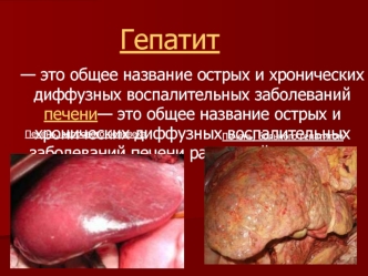 Гепатит. Лечение гепатита