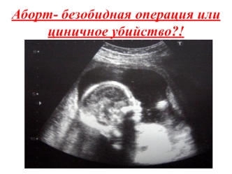 Аборт- безобидная операция или циничное убийство?!