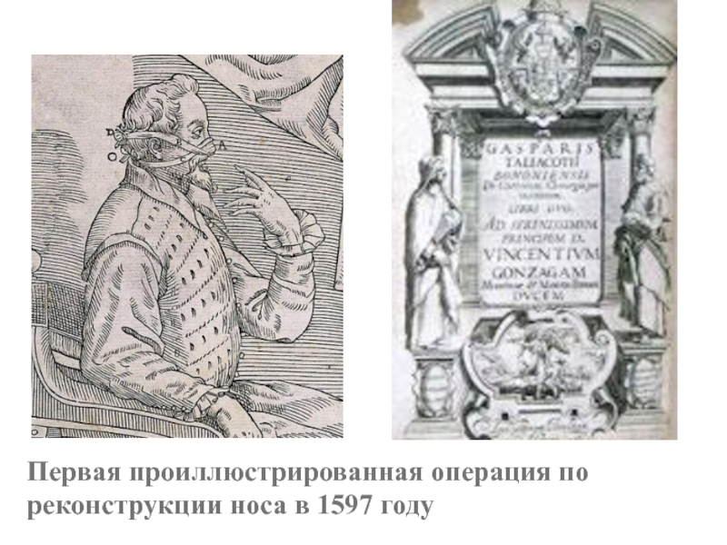 Медицина в западной европе в эпоху средневековья. 1597 Год Европа. Операции в эпоху Возрождения с криками. Что было в 1597 году в Европе.