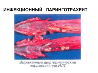 Инфекционный ларинготрахеит