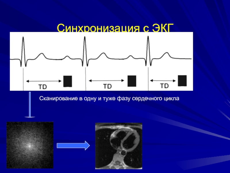 Синхронизация с ЭКГСканирование в одну и туже фазу сердечного цикла