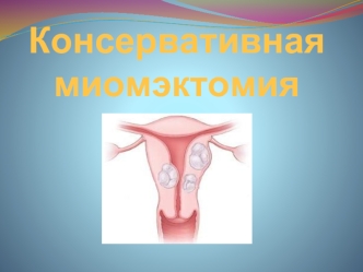 Консервативная миомэктомия