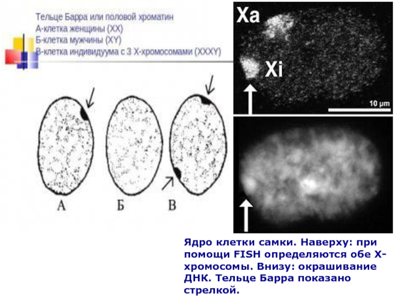 Ядро клетки самки. Наверху: при помощи FISH определяются обе Х-хромосомы. Внизу: