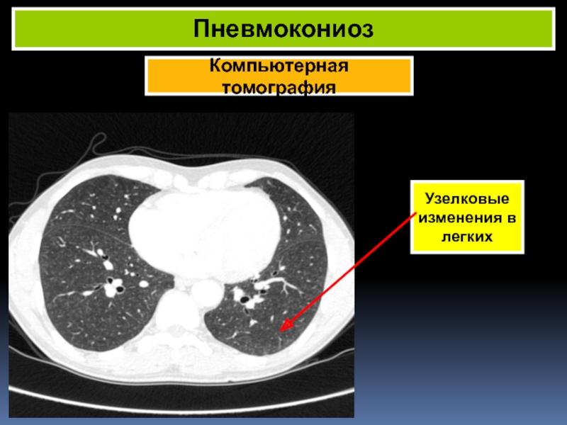 Кт картина может соответствовать