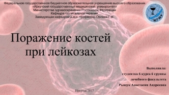Поражение костей при лейкозах