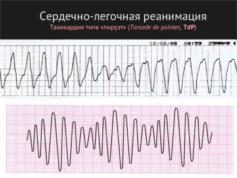 Жт типа пируэт картинки