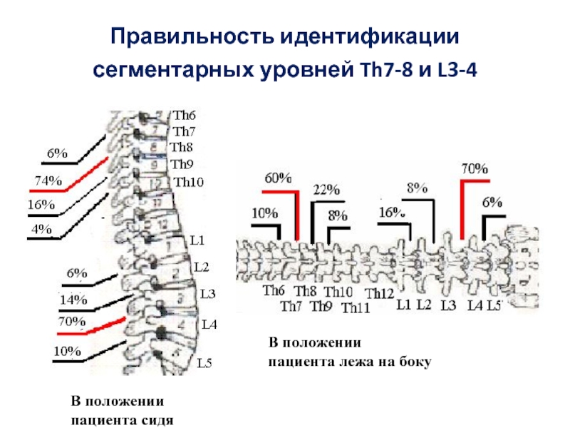 Поперечный распил грудной полости на уровнях th4 th6 th9 схема