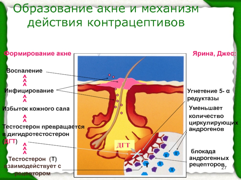 Патогенез акне схема