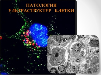 Патология ультраструктур клетки