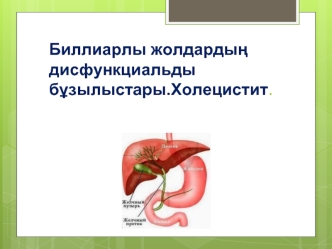 Биллиарлы жолдардың дисфункциальды бұзылыстары.Холецистит