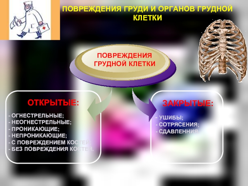 Травма грудной клетки код. Травмы грудной клетки презентация. Непроникающее ранение грудной клетки. Непроникающая травма грудной клетки.