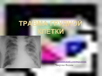 Травма грудной клетки