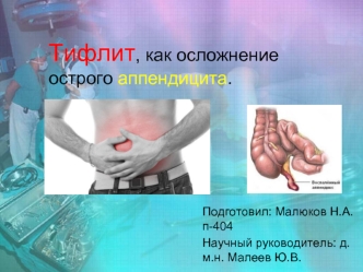 Тифлит как осложнение острого аппендицита