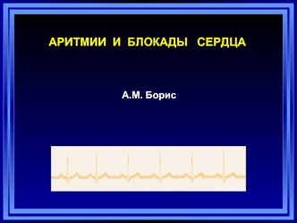 Аритмии и блокады сердца