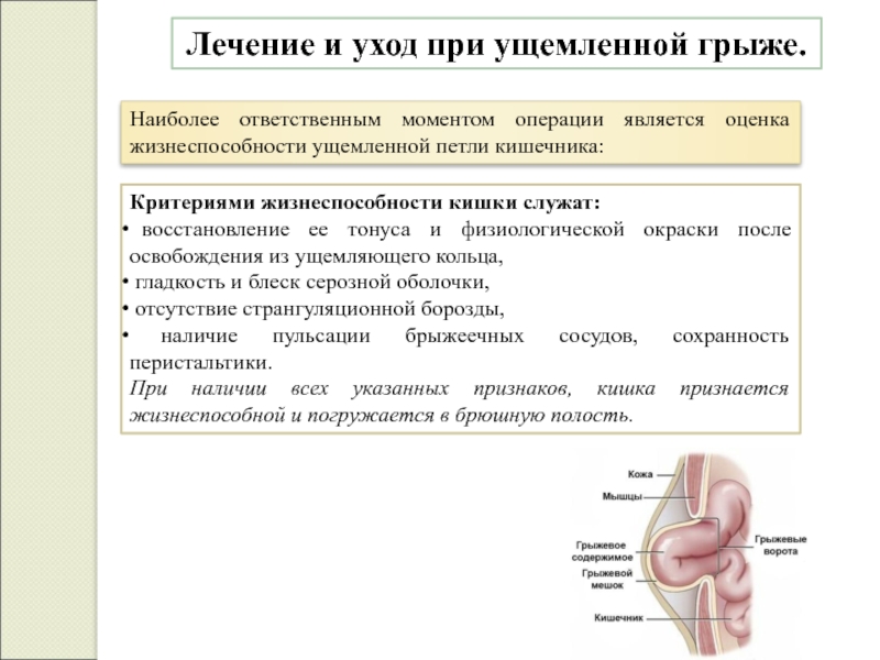 Лечение ущемленной грыжи