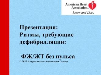 Ритмы, требующие дефибрилляции: ФЖ/ЖТ без пульса