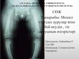 Мешел тәріздес аурулар жіне бой өсудің , тіс дамуының өзгерістері