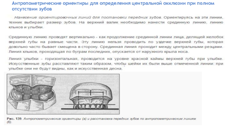 Определение центрального соотношения челюстей при полном отсутствии зубов презентация