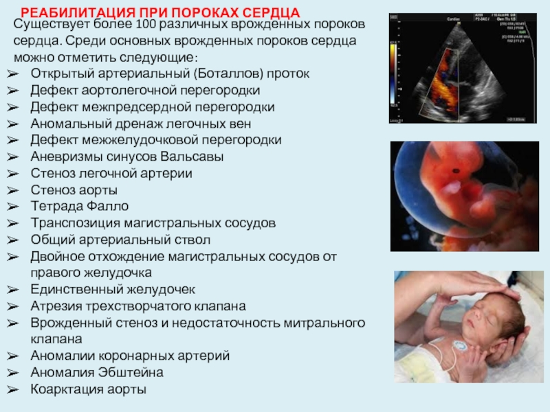 Реферат: ЛФК при врожденных пороках сердца