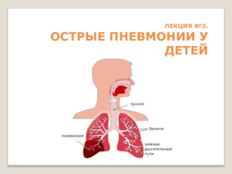 Острые пневмонии у детей. (Лекция 3)