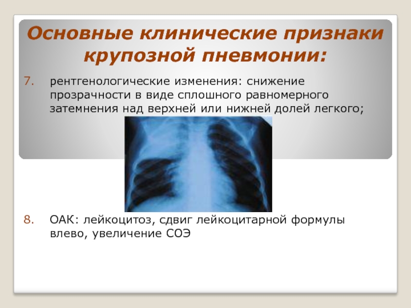 Реферат: Острая внебольничная правосторонняя очаговая пневмония в нижней доле (история болезни)