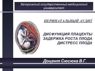 Перинатальный аудит. Дисфункция плаценты. Задержка роста плода. Дистресс плода