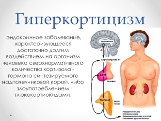 Гиперкортицизм