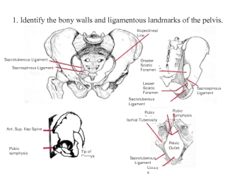 Identify the bony walls and ligamentous landmarks of the pelvis