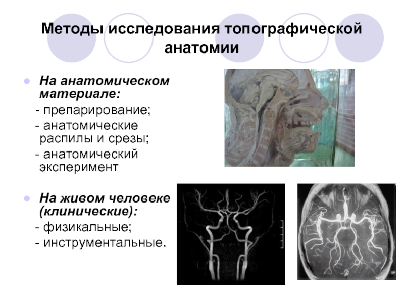 3 анатомических метода