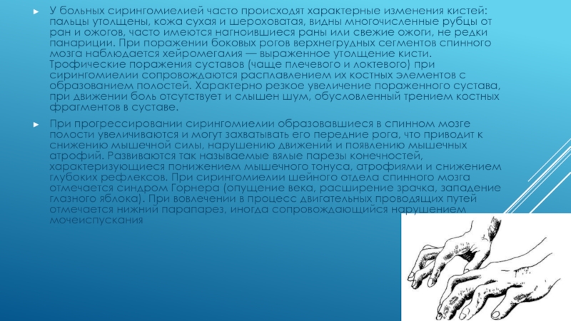 Как часто осуществляется. Для сирингомиелии характерно поражение. Ожоги при сирингомиелии. Сирингомиелия пациенты. Трофические изменения кистей и пальцев у больного сирингомиелией.