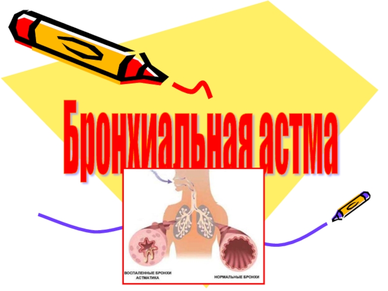 Презентация бронхиальная астма дипломная работа