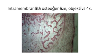 Intramembranālā osteoģenēze, objektīvs 4x