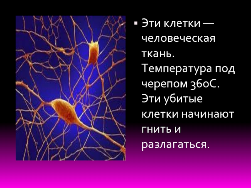 Клетки убивают клетки. Английский язык убивает клетки мозга русского.