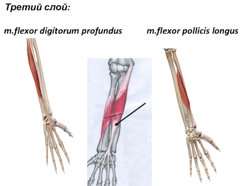 Montagem vozes profundus. Flexor pollicis Longus. M Flexor pollicis Longus. M. Flexor pollicis Longus и m. Flexor digitorum Profundus. Musculus Flexor pollicis Longus мышца.