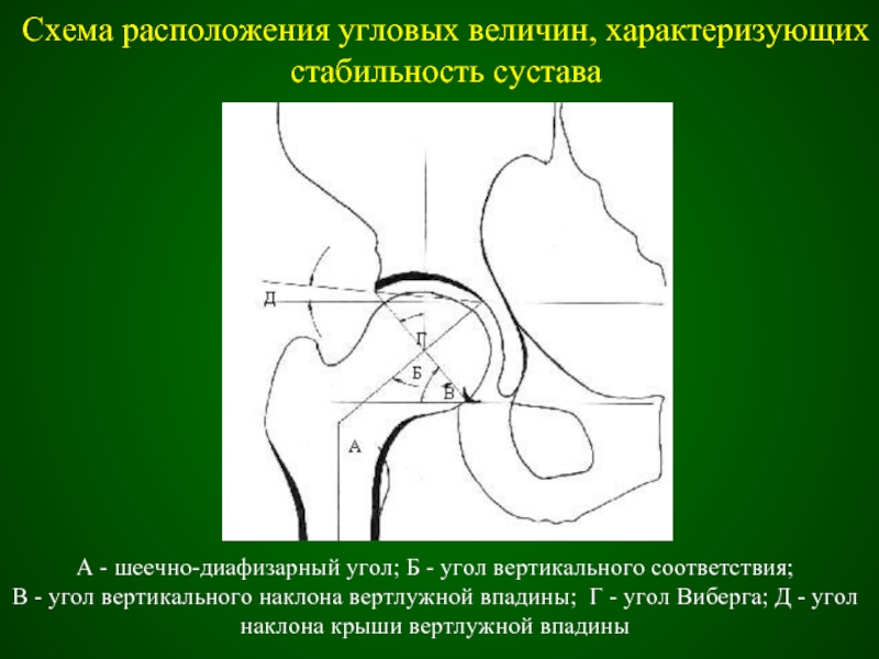 Карта тбс банка