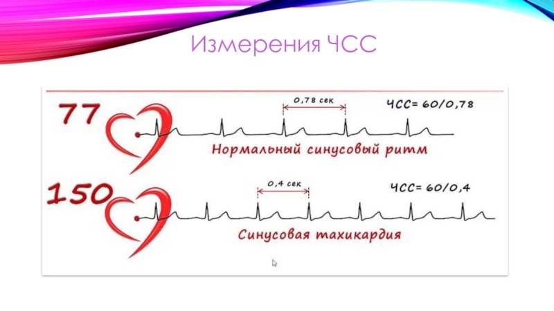 Основы экг презентация