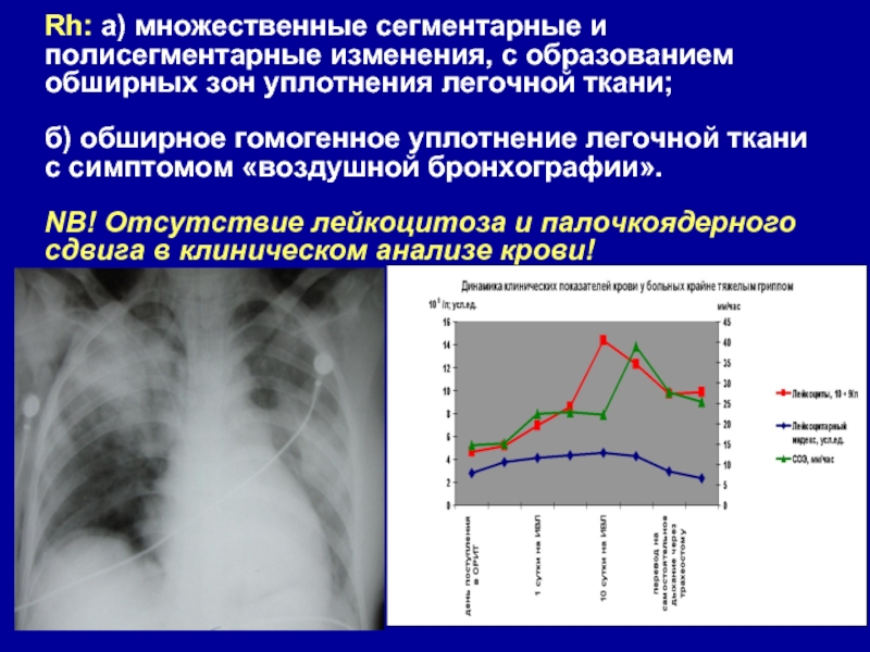 Двухсторонняя пневмония карта вызова