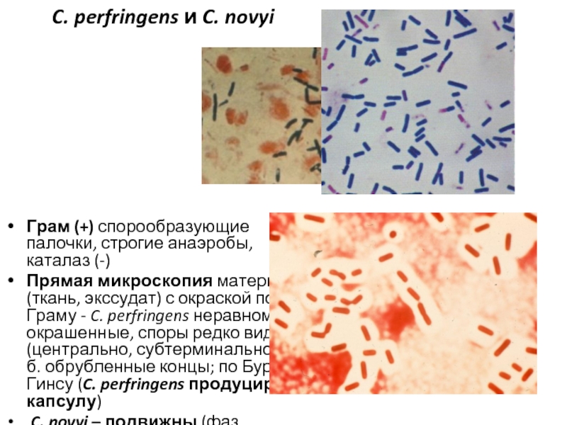 Клостридии фото микроскопия