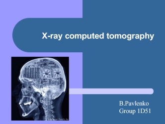 X-ray computed tomography