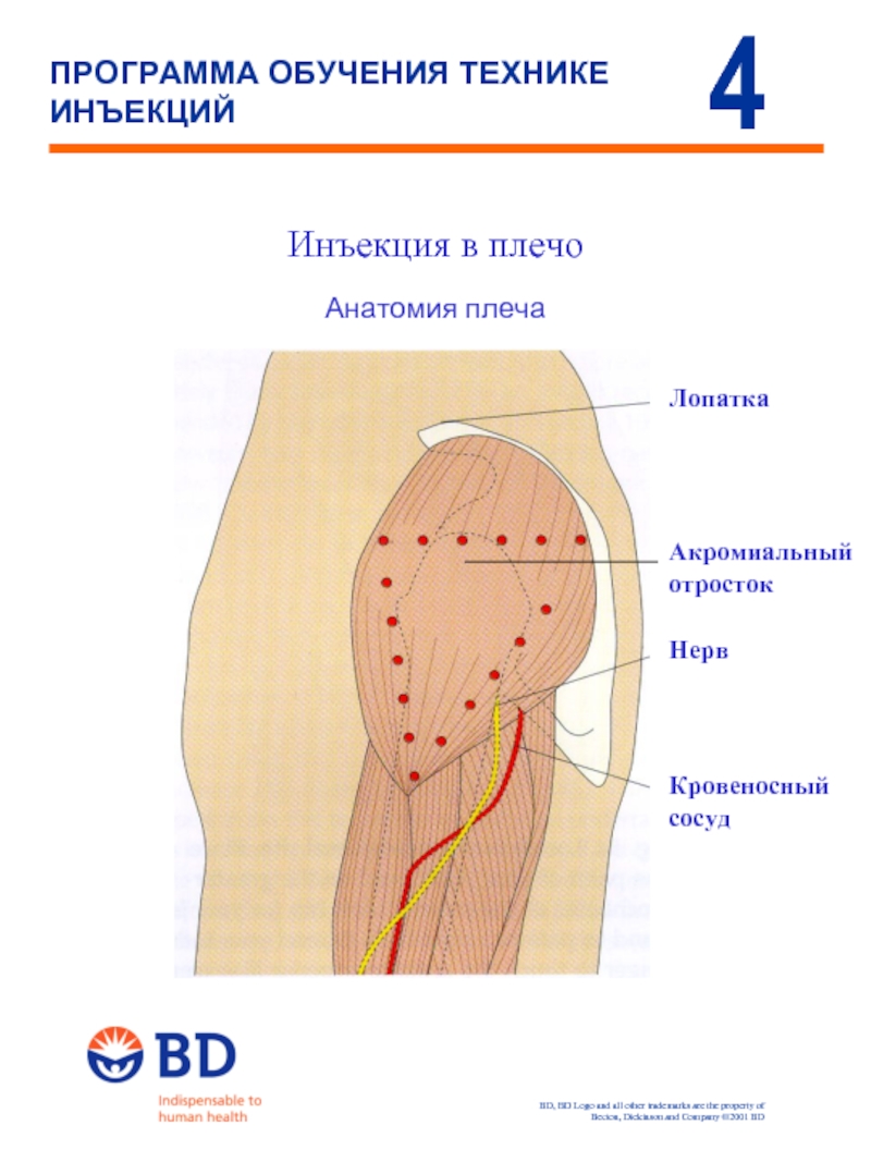 Как колоть в руку. Как поставить укол в плечо внутримышечно. Как колоть укол в плечо внутримышечно. Как делать укол в дельтовидную мышцу. Техника выполнения ВМ инъекции в плечо.